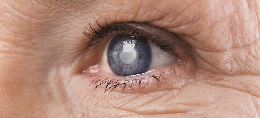 World Glaucoma Week 2020