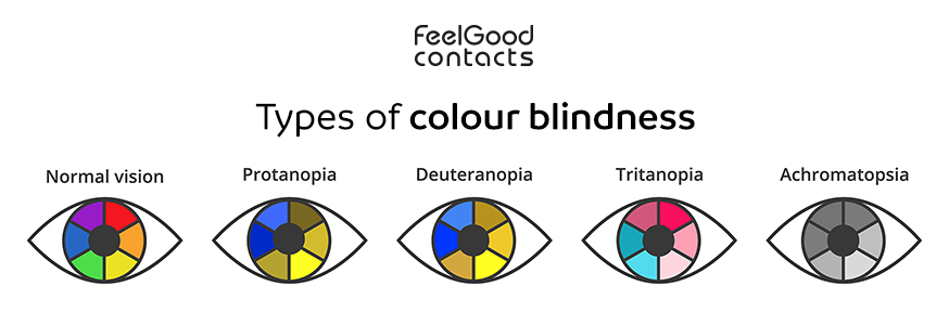 Types of colour blindness