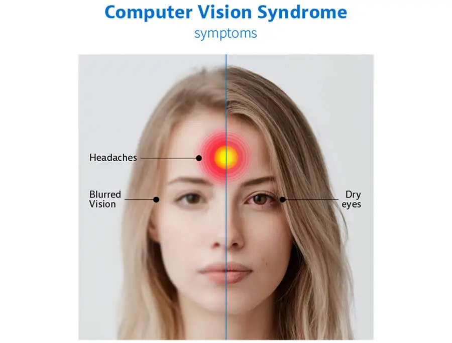computer vision syndrome 2