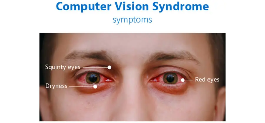computer vision syndrome 3