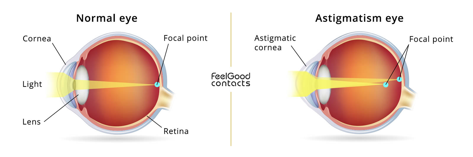 how-do-glasses-work-for-astigmatism-sunny-newcomb