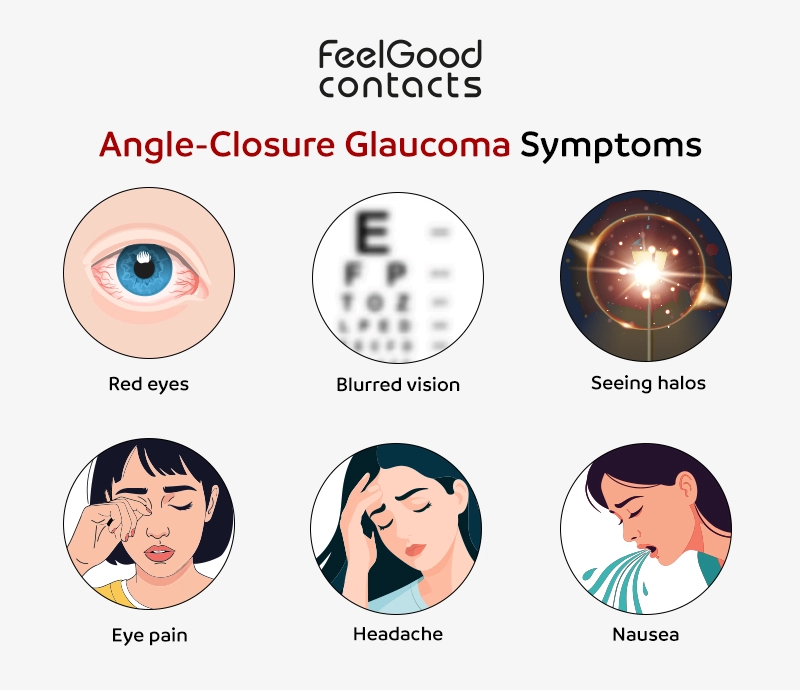 Angle-closure glaucoma symptoms