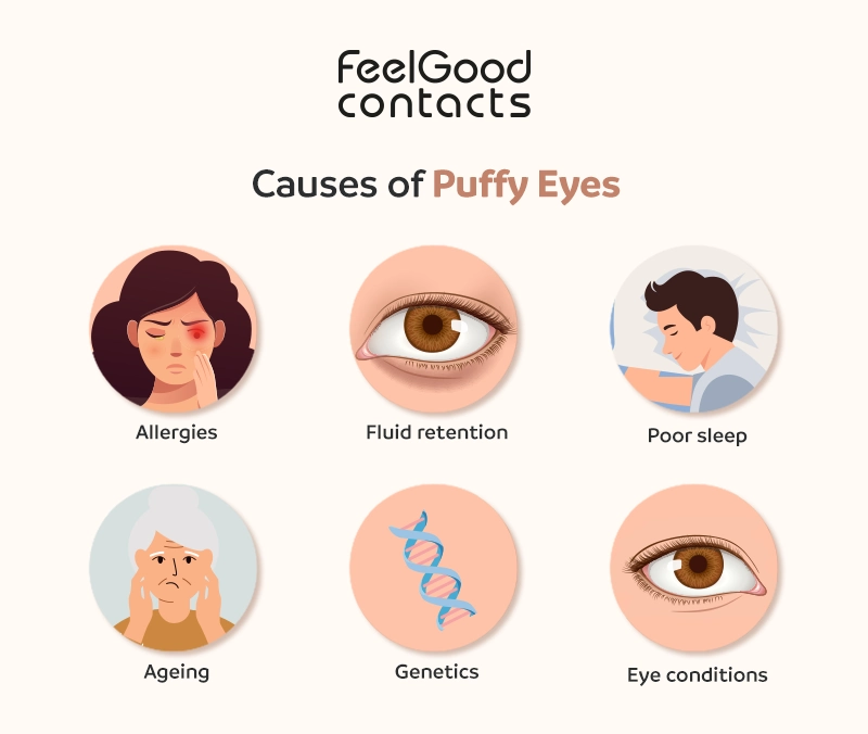 Causes of puffy eyes