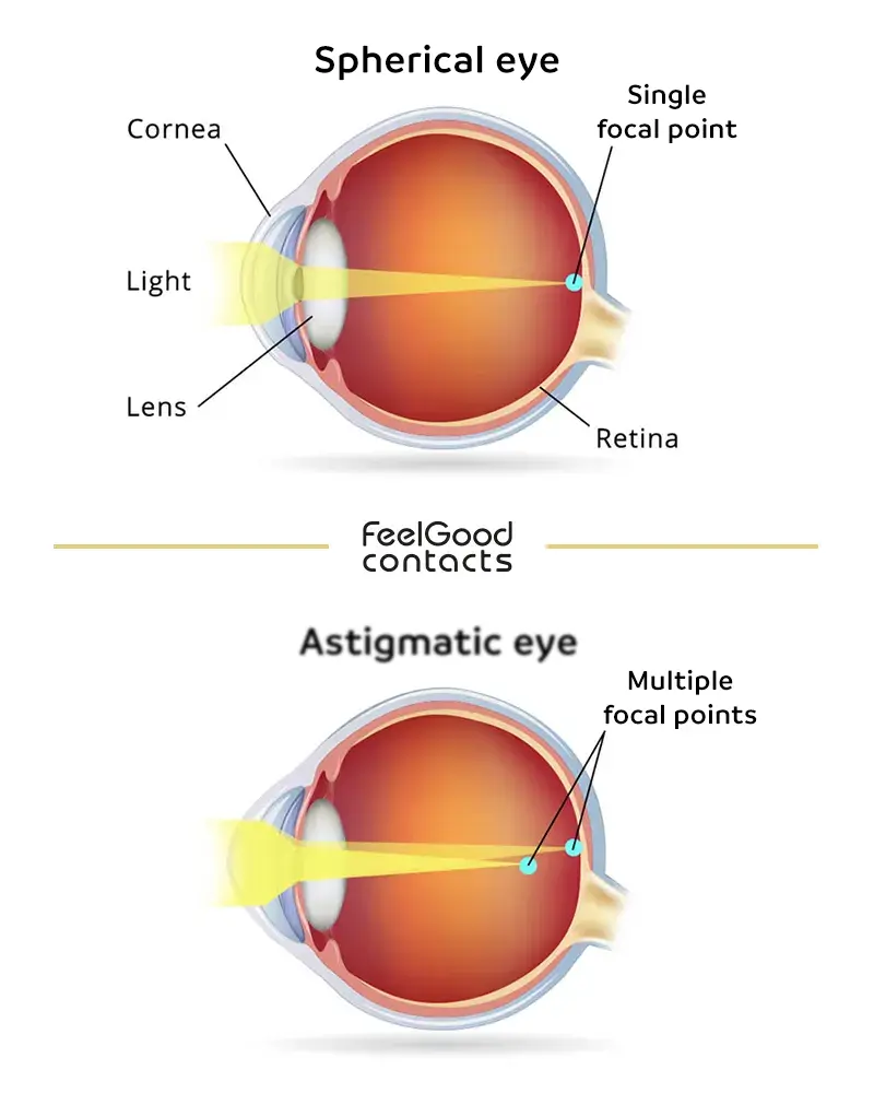 20/20 vision vs Astigmatism. How eye functions.