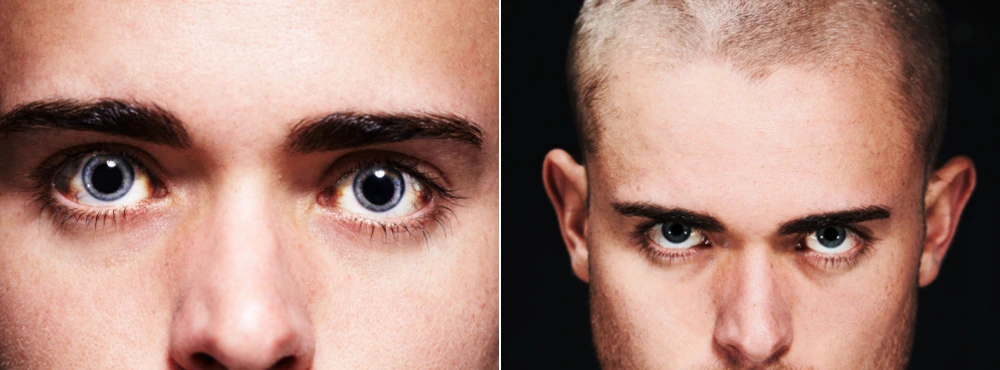 manic vs depressive bipolar eyes