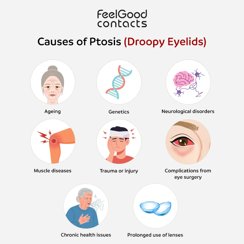 ptosis causes