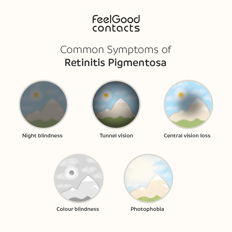 Retinitis pigmentosa symptoms