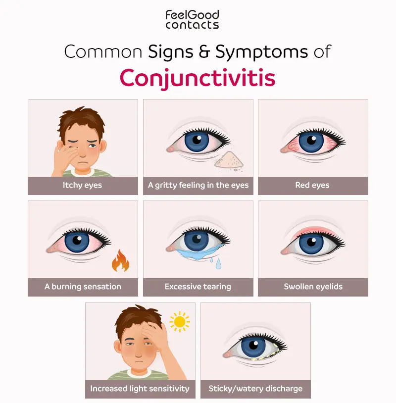 Signs and Symptoms of Conjunctivitis