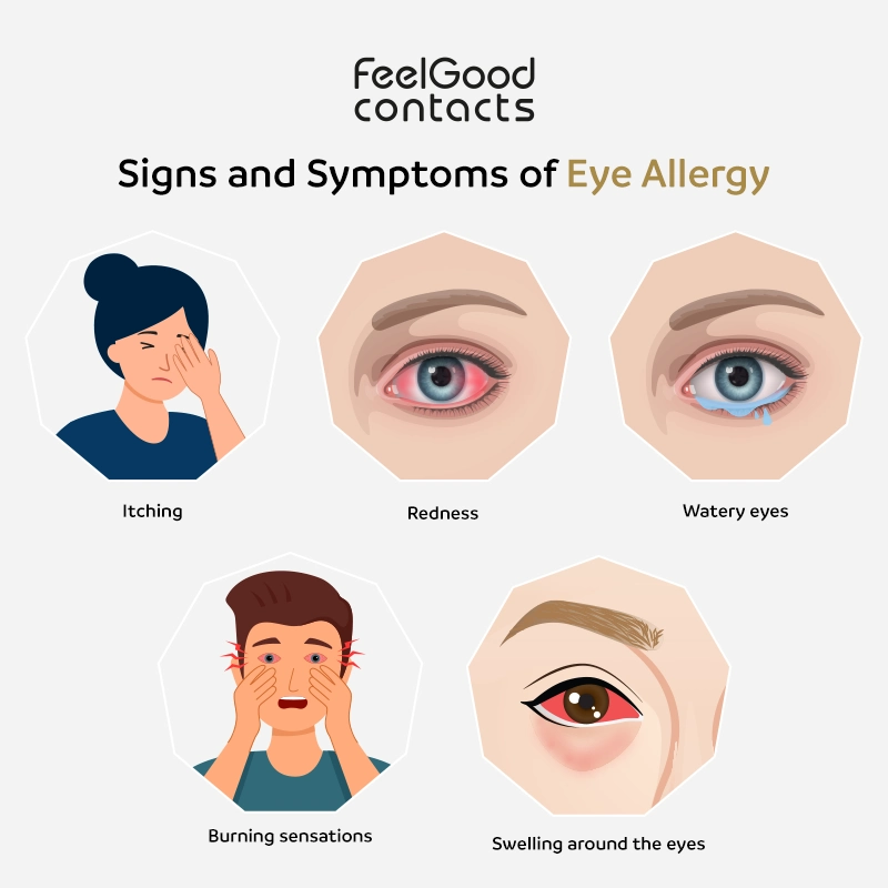 Symptoms of an eye allergy
