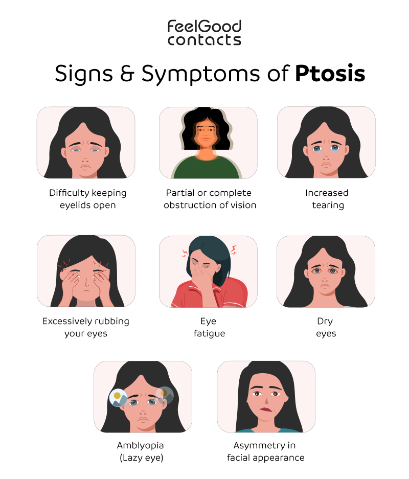 signs and symptoms of ptosis