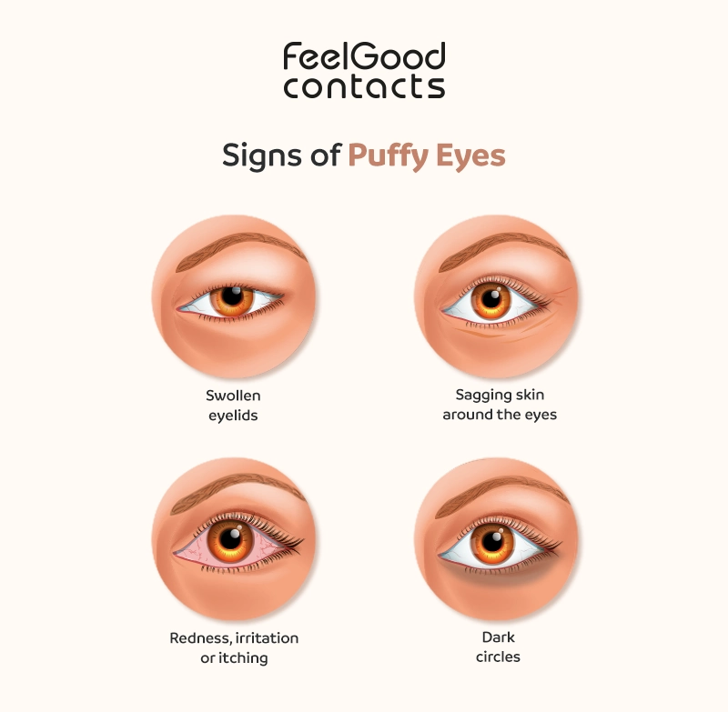 Signs of puffy eyes