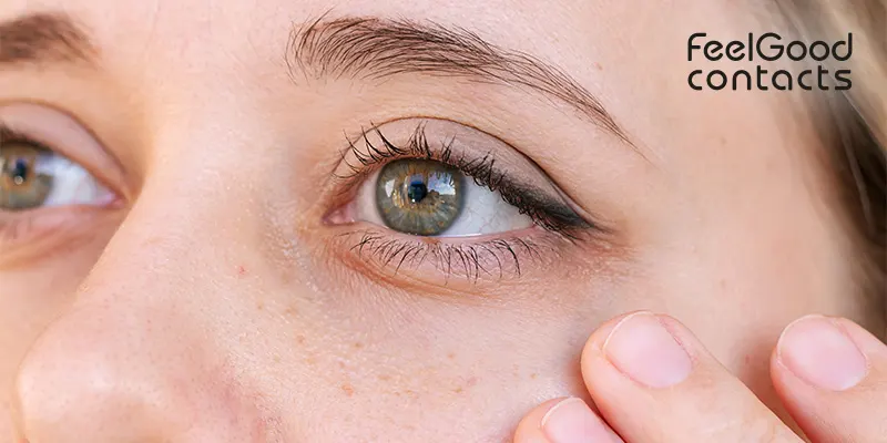 Symptoms of photokeratitis