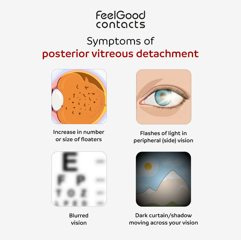 Symptoms of posterior vitreous detachment