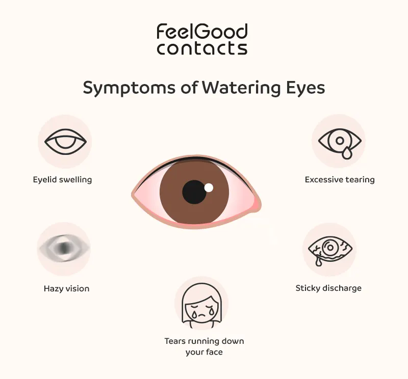 Symptoms of watering eyes