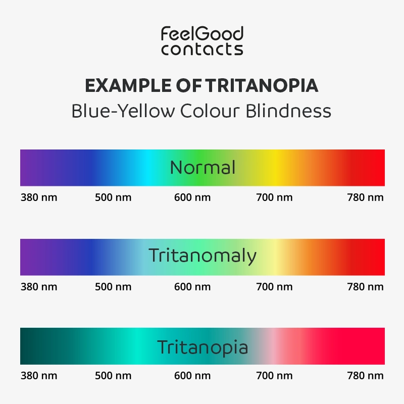 tritanopia