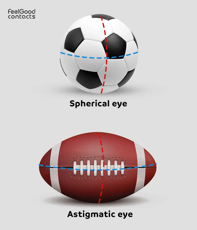 20/20 vision vs astigmatism (shape of the eye)
