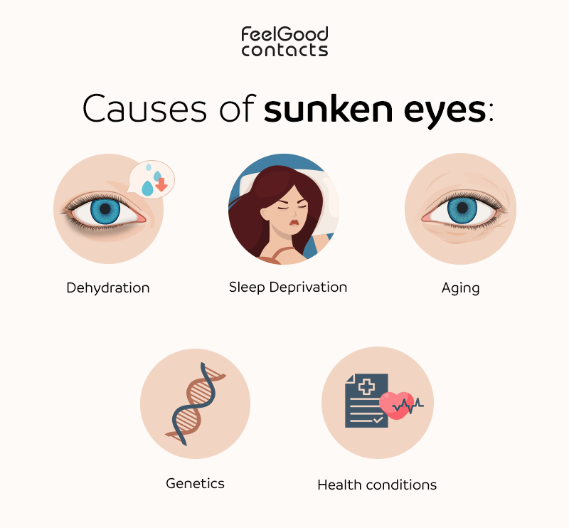what causes sunken eyes