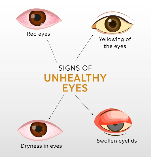 Common signs of unhealthy eyes