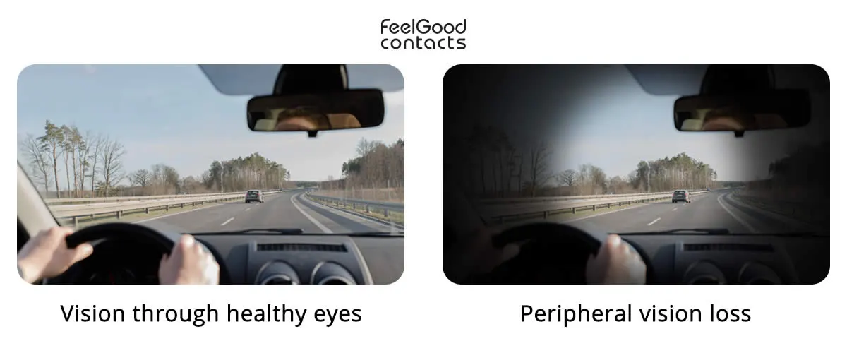 What is peripheral vision? Feel Good Contacts
